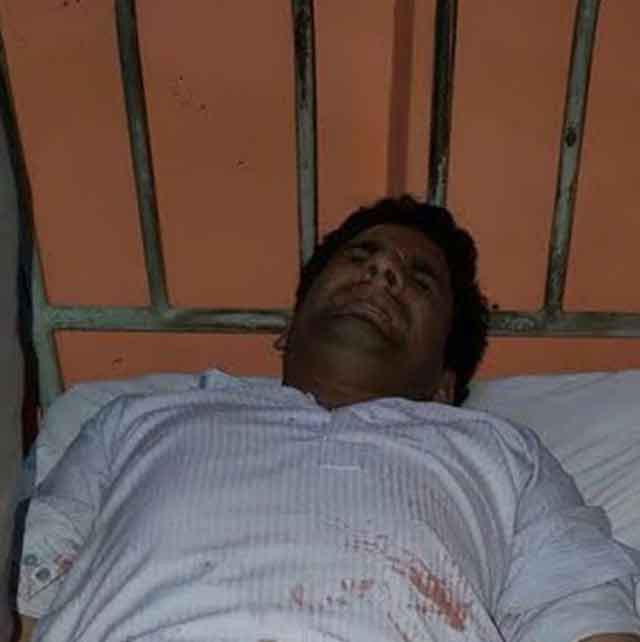 Kocasının penisini kesti yemek yaptı sebebi ise şoke etti - Resim: 3