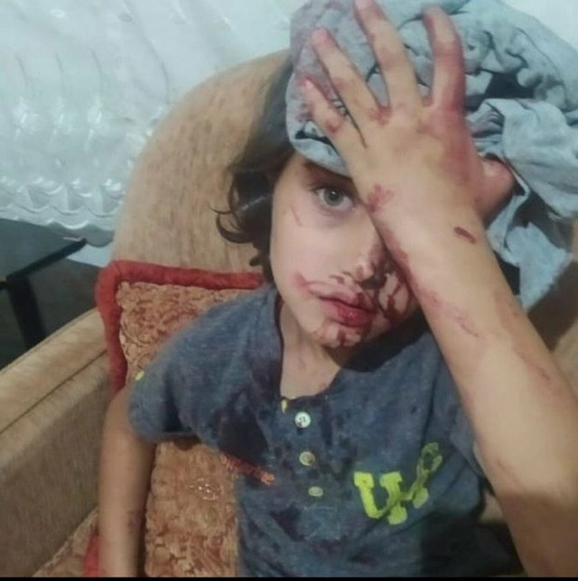 Ankara'da Suriyelilerin dükkanlarına saldırdılar! Halk sokağa döküldü - Resim: 1