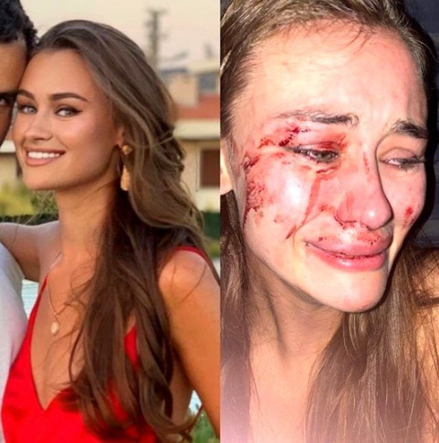 Daria Kyryliuk'un gördüğü şiddetin görüntüleri olay! İddiaları reddetti - Resim: 2