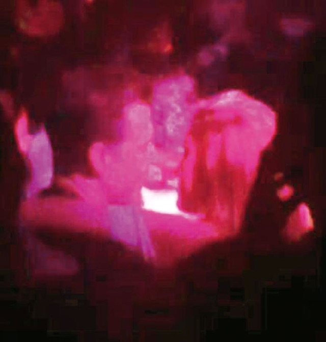  Erdem Kınay'ın evli olduğunu unuttuğu gece - Resim: 2