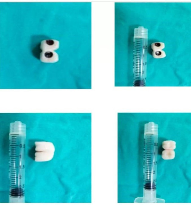 Diş tedavisinde hastanın başına geleni duyanlar şaştı kaldı ölümden döndü - Resim: 0