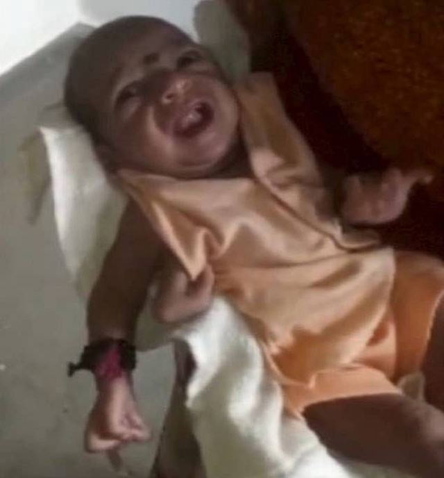 3 kollu doğan bebeği 'peygamber' ilan ettiler - Resim: 3