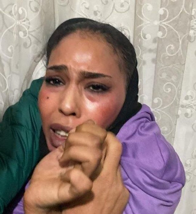 Taksim saldırısında şok detaylar! Kritik ismi Bilal Hassan aranıyor emri bakın kim vermiş - Resim: 1