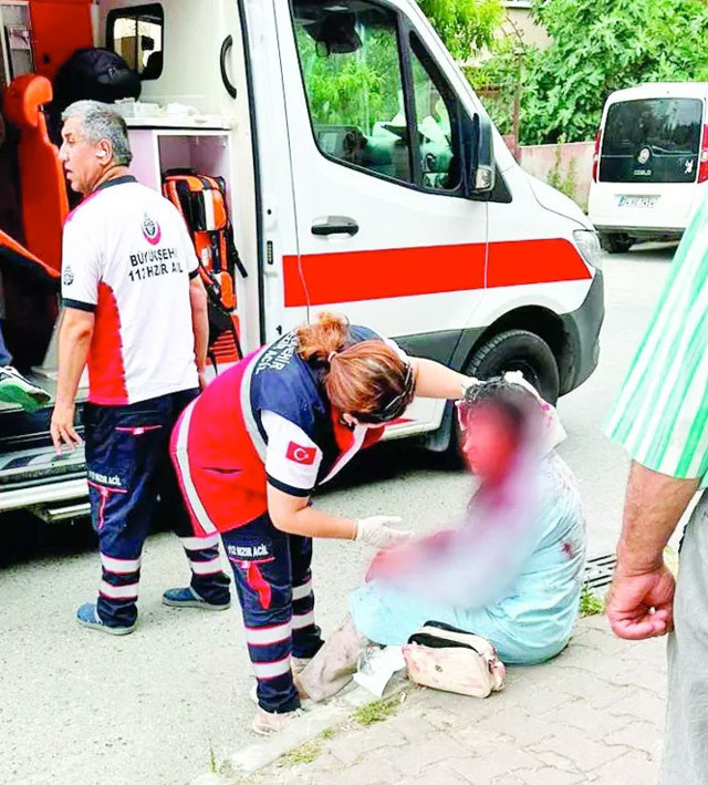 Ataşehir'de köpek kadının kafasını parçaladı yolan geçenler zor ayırdı sahibi gözaltına alındı - Resim: 0