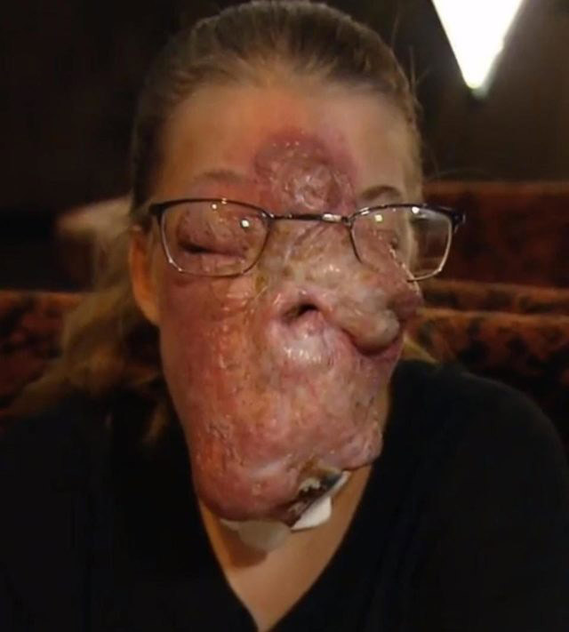 Küçük bir doğum lekesiyle doğdu 14 sene sonra bakın ne hale geldi! - Resim: 4