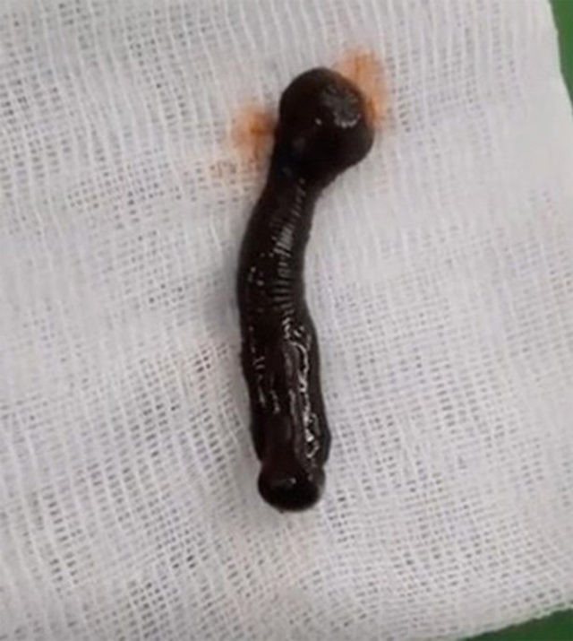 Migren için ameliyata girdi ancak ağzından öyle bir şey çıktı ki! - Resim: 4