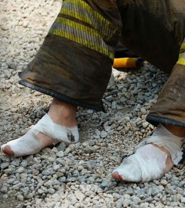 Ayakları sargı içinde olan itfaiye eri yangın bölgesinden ayrılmadı - Resim: 0