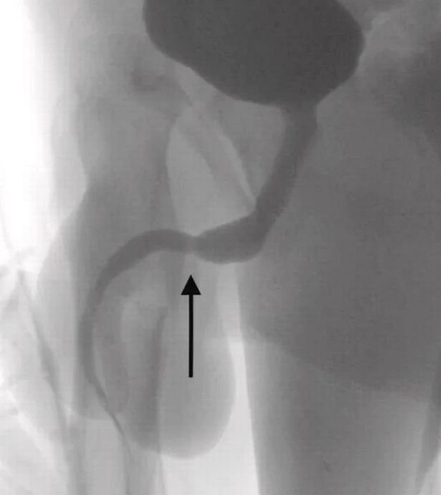 Tıp literatürüne girdi! Merakı başına bela oldu: Doktorlar cinsel organından ameliyatla bakın ne çıkardılar! - Resim: 0