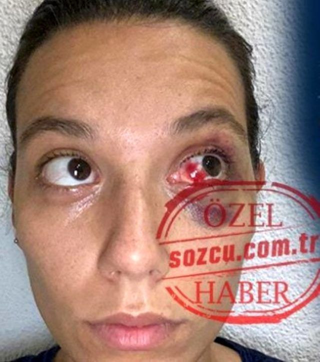 Ozan Güven Deniz Bulutsuz'u 1 saat dövdü! Hakkında rol arkadaşları bakın neler söyledi - Resim: 2