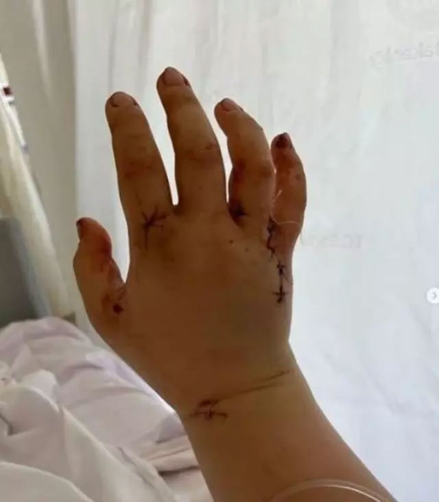 Öldürülmek istenen Youtube fenomeni Merve Veziroğlu: "58 kesik vardı, gözümü açtığımda kanlar fışkırıyordu" - Resim: 0