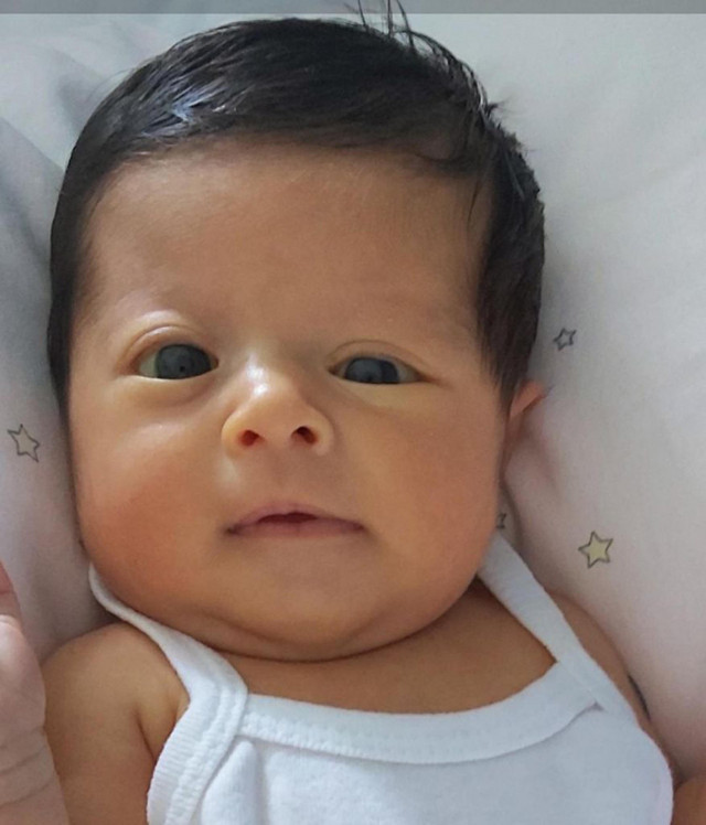 İki aylık bebeğin kafatası birden yamuk büyümeye başladı! Doktorlar uyardı babaanne yöntemi denemeyin! - Resim: 0