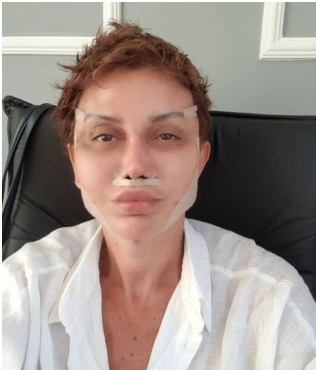 Seda Sayan estetiği yaptıran Serap Paköz'ü kızdırdılar: Beleşçi değilim! - Resim: 1