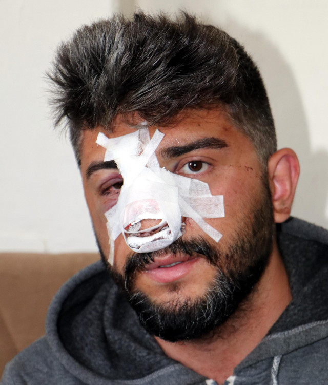 Erzurum'da kavgada yaralanan gencin annesi konuştu - Resim: 0