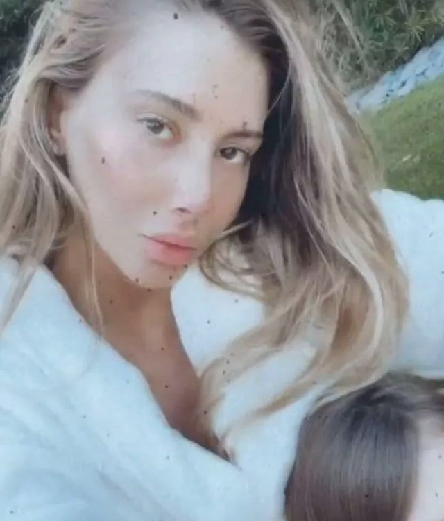 Şeyma Subaşı estetiklerine estetik kattı yüzündeki değişim olay! - Resim: 4