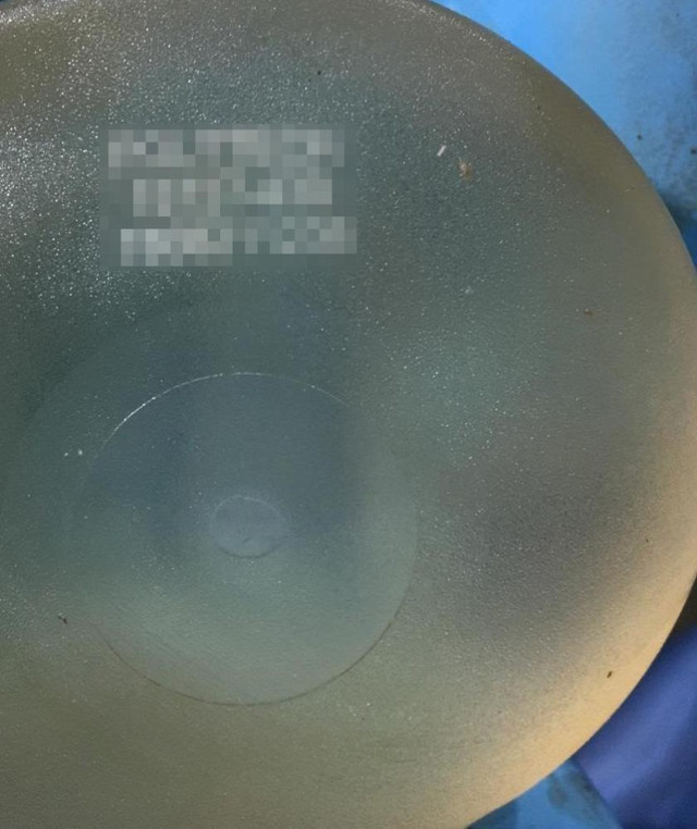 Parçalanmış cesetler çöp poşetinde bulunmuştu: Kesik baş cinayetinde yeni gelişme! - Resim: 4