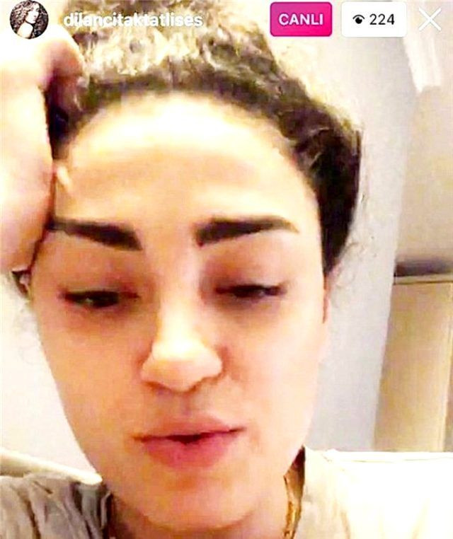 İbrahim Tatlıses'in kızı Dilan Çıtak herkesi korkuttu sevgilisi koronavirüs olmuştu - Resim: 4