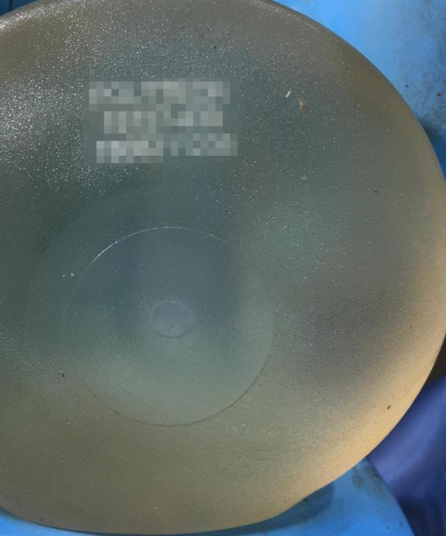 Sakarya'daki kesik baş cinayetinde flaş gelişme: Parçalara ayrılan cesetler çöp poşetinde bulunmuştu! - Resim: 4