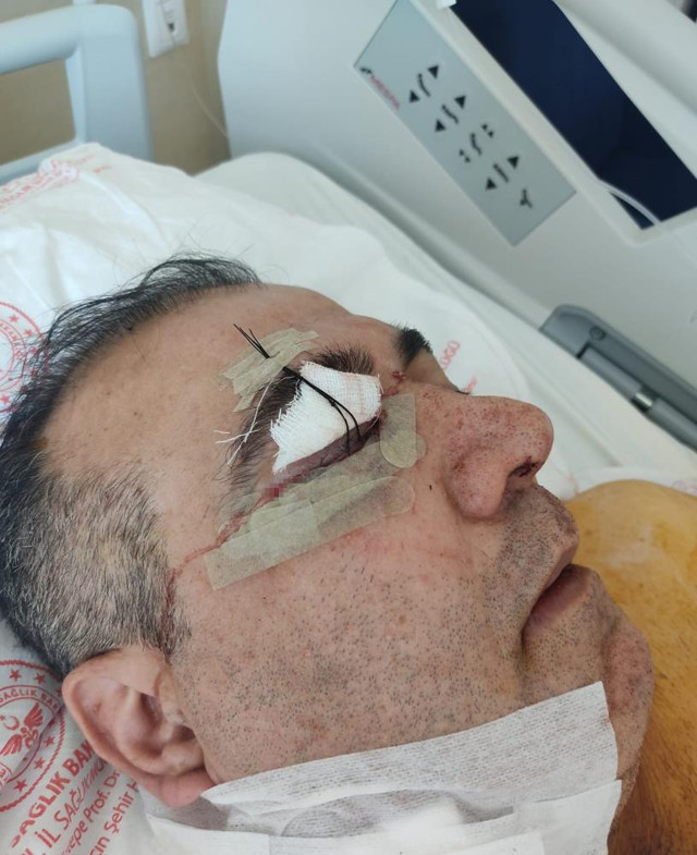 Hakkını istedi boynundan vuruldu! Ataşehir'de dehşet verici olay - Resim: 1