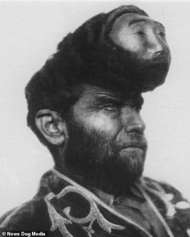 Sirklerin en 'ucube' karakterleri! Ucube şovlarıyla ünlenen karakterler - Resim: 4