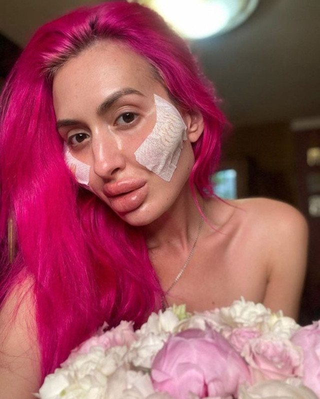 Doktorlar uyardı o vazgeçmiyor! Dünya'da tek olmak istiyor: Ameliyat için yeniden Türkiye'ye geldi! - Resim: 2