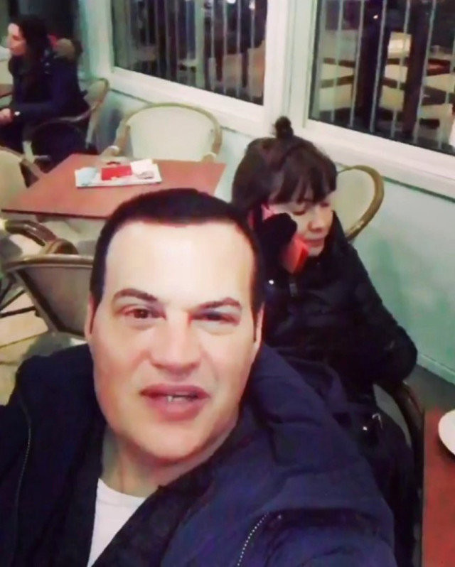 Emrah'tan sonra Hakan Peker faciası estetik var mı yok mu? - Resim: 3