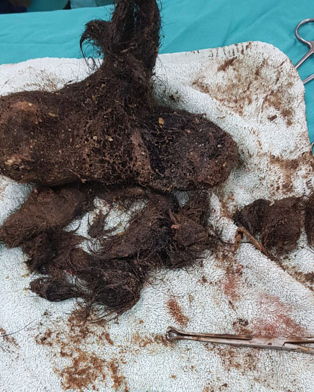 Ameliyatı yapan doktor şoke oldu! Midesinden çıkana bakın - Resim: 4