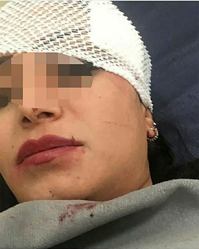 Pavyonda eski eşiyle gördüğü arkadaşının yüzünü jiletle kesti! '76 günün acısı kötü olacak' - Resim: 0