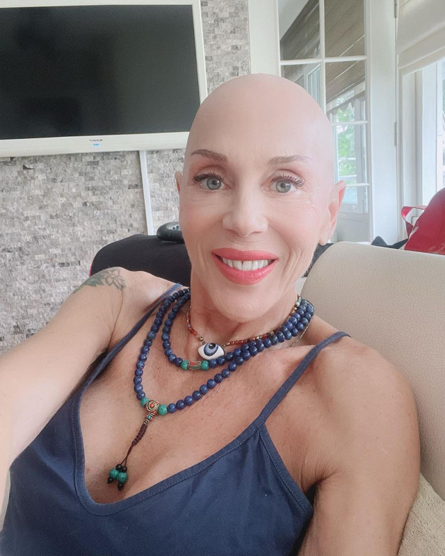 Kanserle mücadele eden Billur Kalkavan sosyal medyadan böyle duyurdu! O haberi sevenlerini ağlattı - Resim: 2