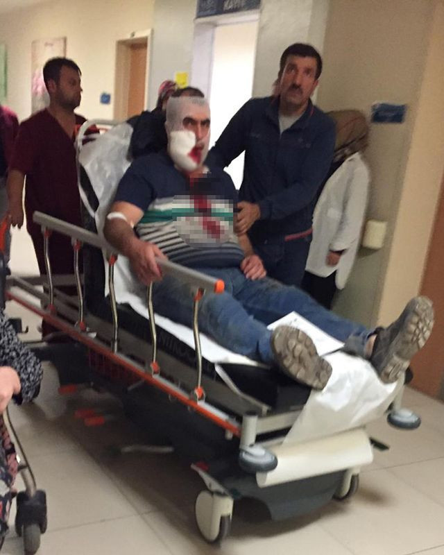 Bursa'da vincin kancası yüzüne çarpan işçi ağır yaralandı - Resim: 3