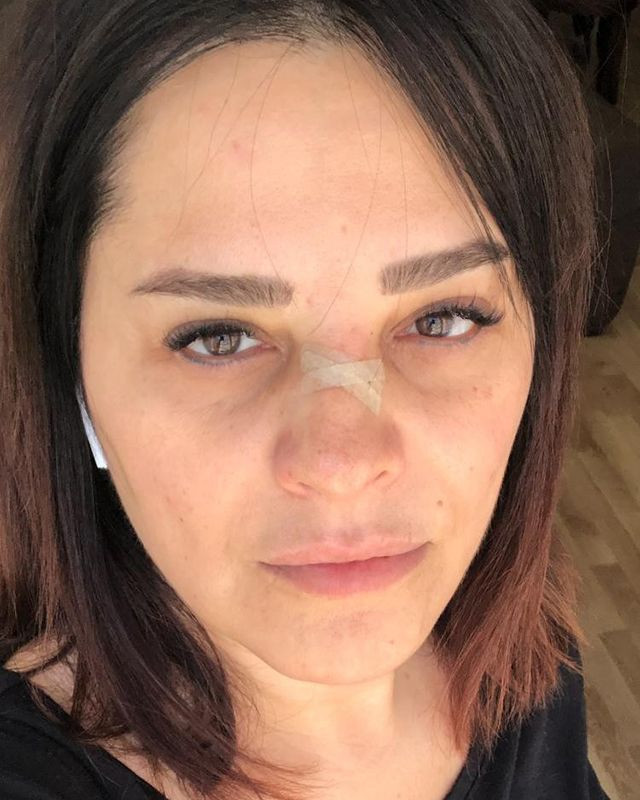 Ünlü şarkıcı Reyhan Karaca’nın burnu kırıldı - Resim: 4