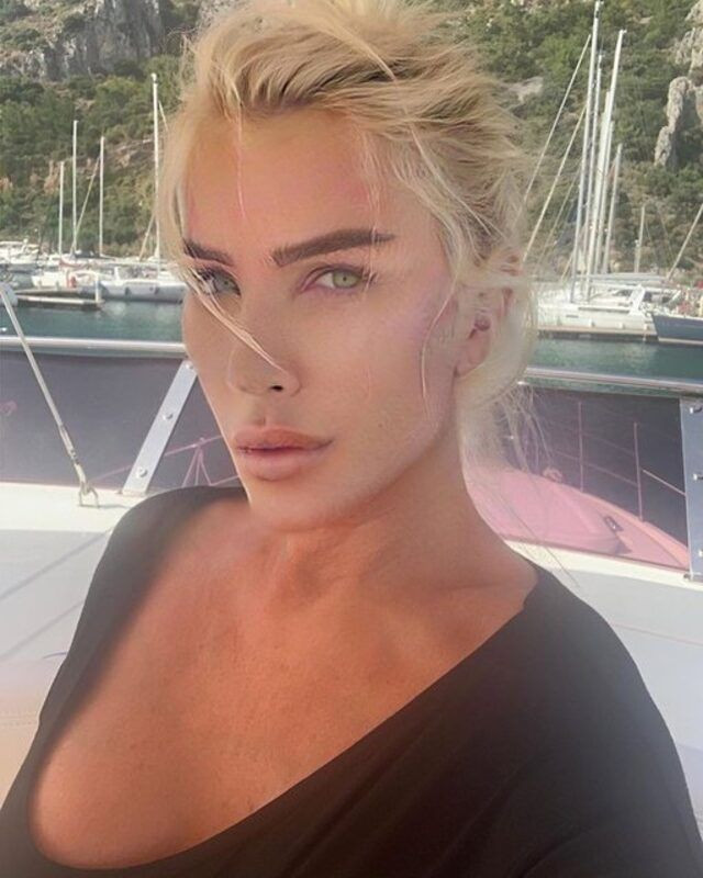 Seda Sayan estetik yaptırdığı anlardan sonra ilk kez paylaşım yaptı gören şaştı - Resim: 4