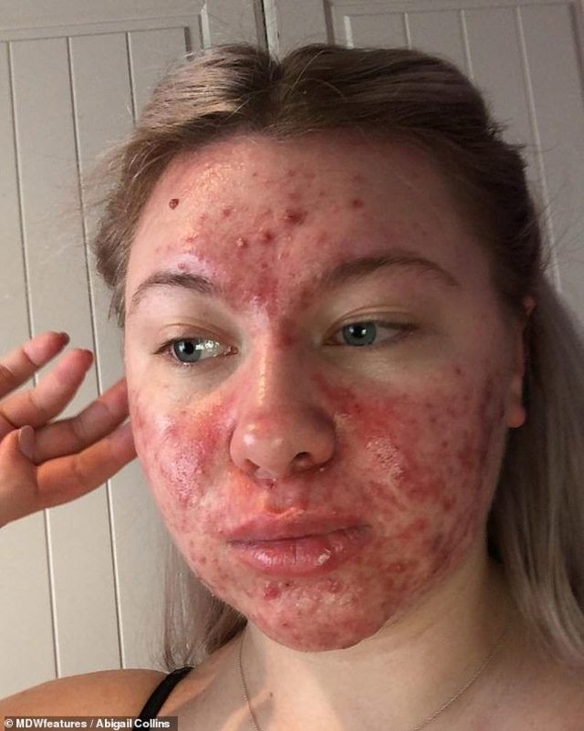 Genç kızın acı dramı günde 2 saatini makyaja harcıyor! İşte sebebi - Resim: 4