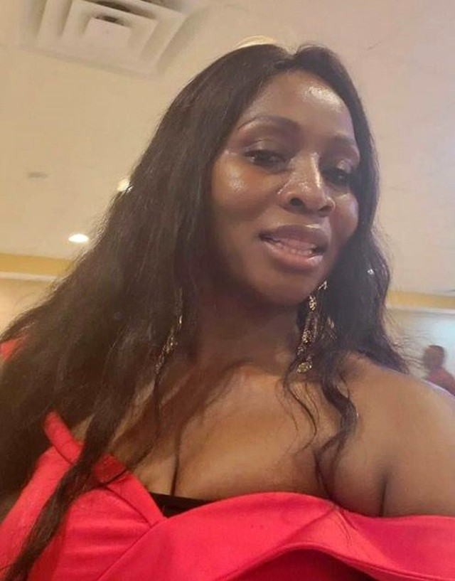 İstanbul'da ölümüne estetik! ABD’li Cleopatra estetik ameliyattan 2 gün sonra öldü - Resim: 1