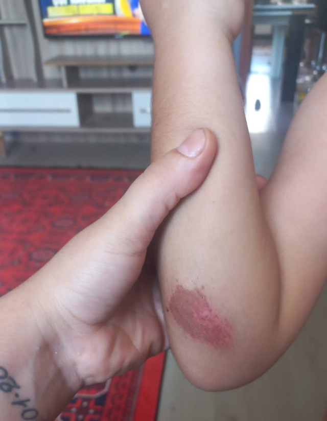 Kocaeli'de hamile kadına meydan dayağı! Bebeğini düşürdü... - Resim: 0