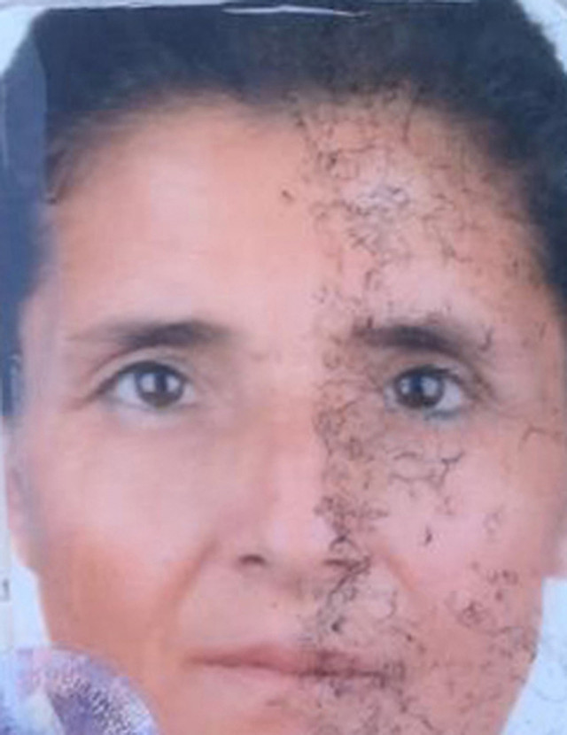 Engelli eşini katletti! Antalya'da katil kocanın cezası belli oldu - Resim: 0