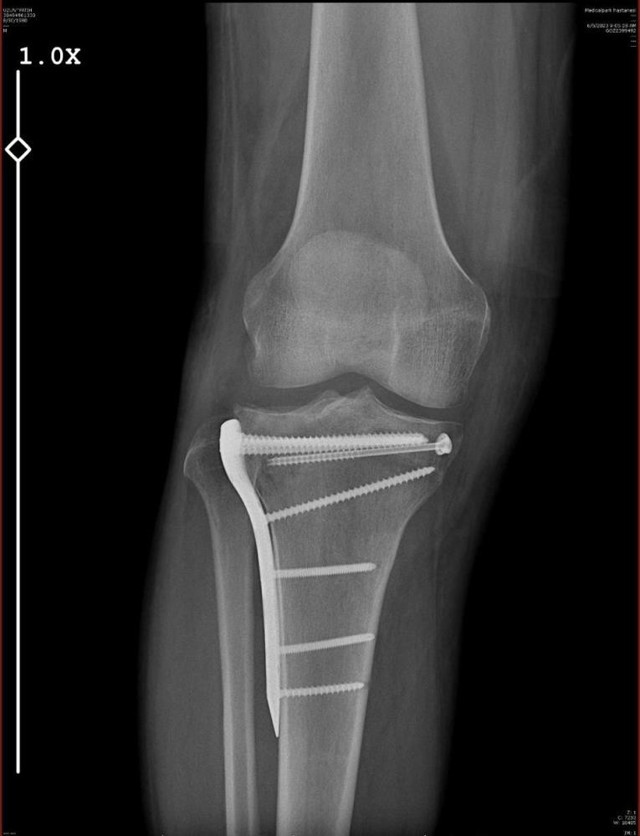 Avukata polis şiddeti: Tatil dönüşü kabusu yaşadı! Darp edildi, bacağı iki yerden kırıldı... - Resim: 3