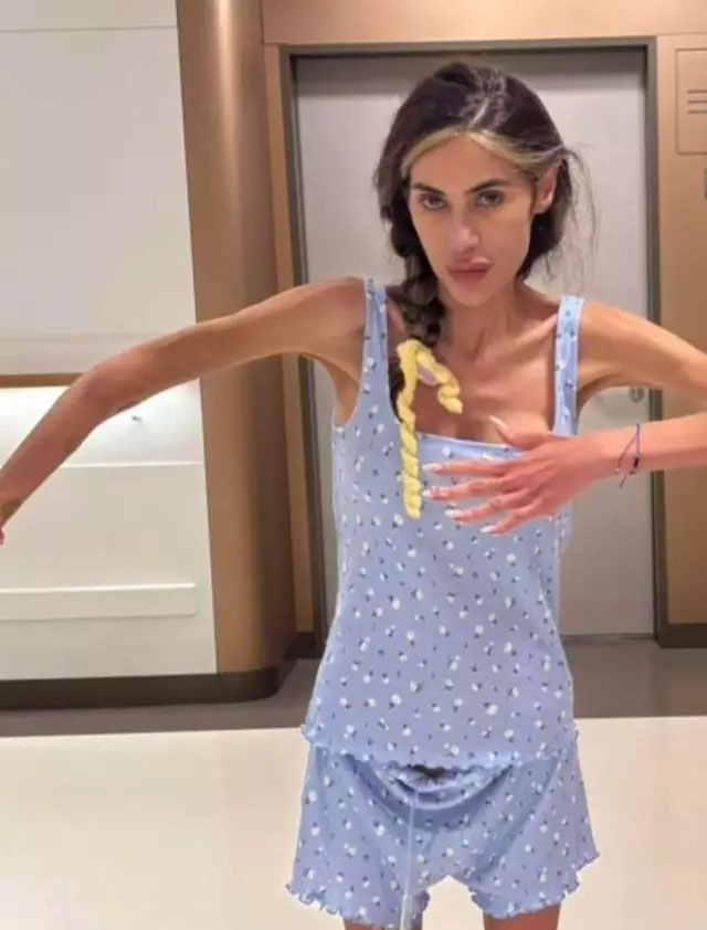 Nihal Candan'ın kalbi durdu 23 kiloya kadar düştü eşinden boşanınca herşeyi bıraktı - Resim: 2