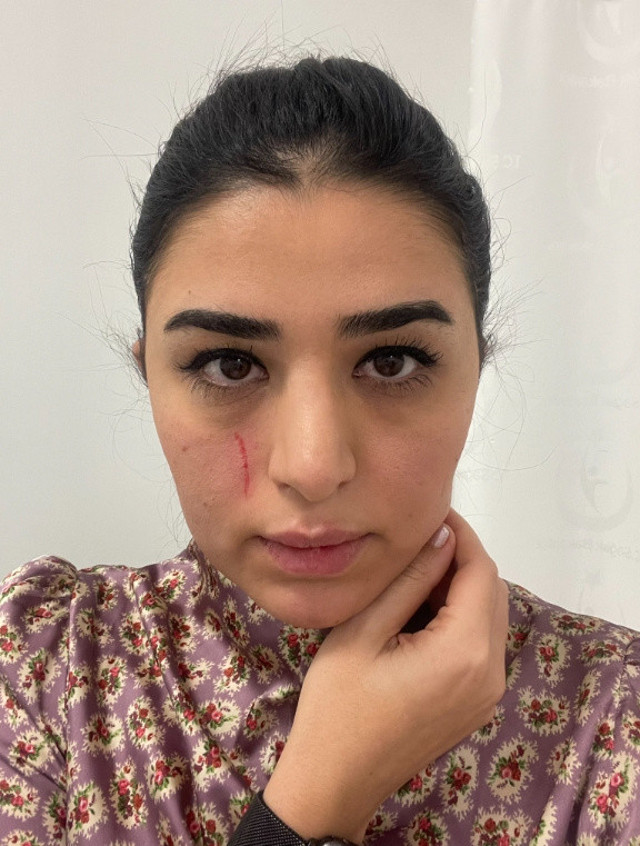 Mersin'de hastanede saldırıya uğradı! Kadın doktor böyle seslendi: "Yayınlayacak mısınız sayın bakanım?" - Resim: 0