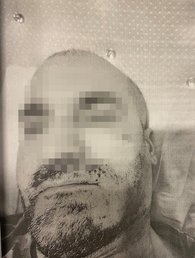 Öğrenci yurdunda akıl almaz işkence! Bağlayıp sakallarını ve saçlarını sıcak ağda ile kökünden söktüler - Resim: 1