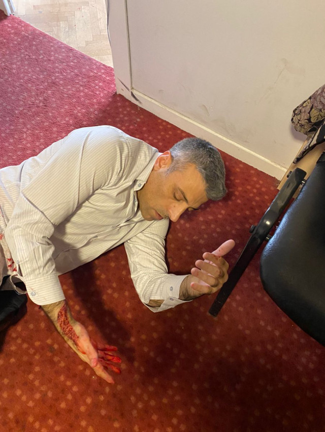 Öztürk Yılmaz bıçaklı saldırıya uğradı - Resim: 1