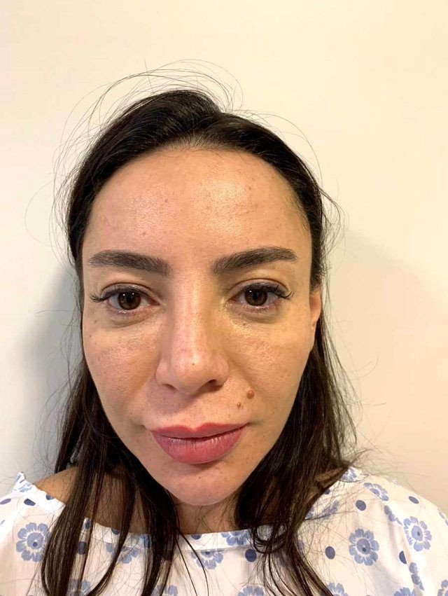 MasterChef'den elenen Suna Aydın estetik yaptırdı yeni projesi belli oldu - Resim: 3