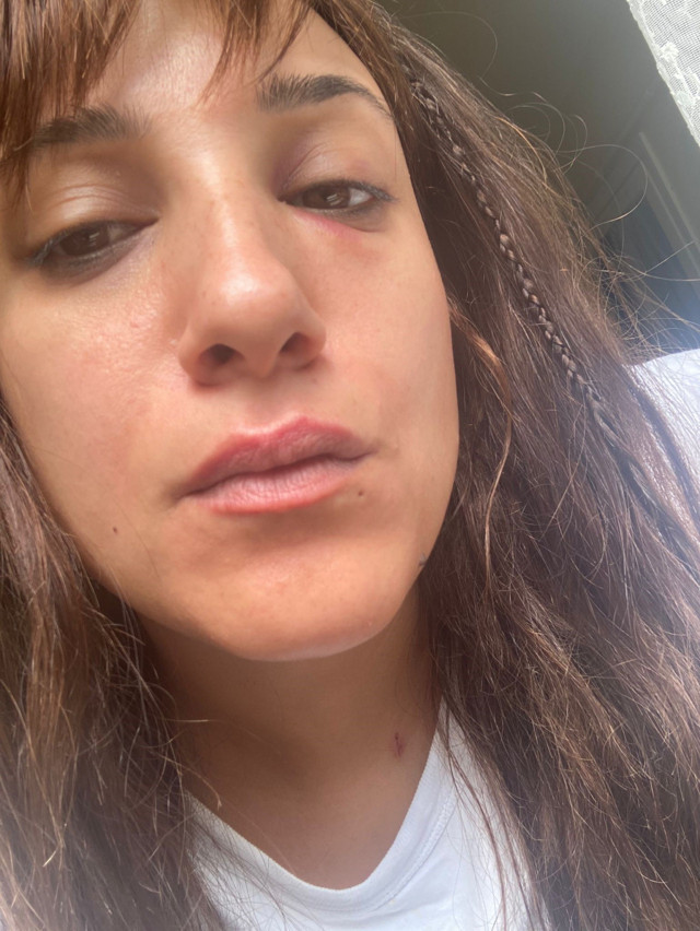 Taksim'de hastanede doktor dehşeti: Kadının gözüne yumruk attı! - Resim: 2