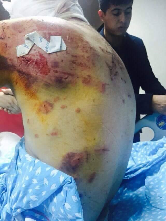 Gazi devletten alacağı milyonluk tazminatı istemedi! Devletin parasına dokunulmaz - Resim: 3