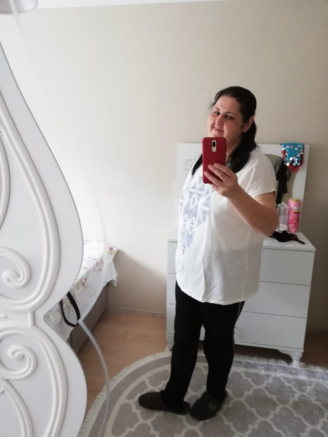 Koronadan korktu şeker ameliyatı oldu 3 ayda 32 kilo verdi - Resim: 0