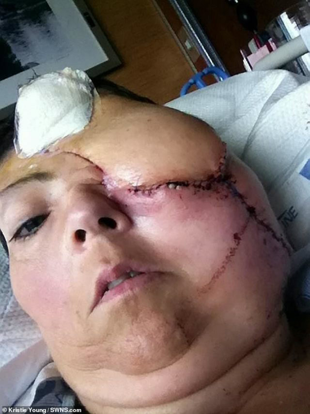 Yüzünde havai fişek patladı! Hayatı bir günde karardı - Resim: 3