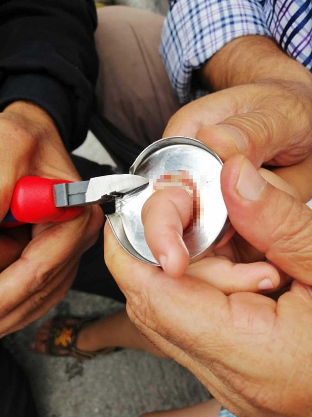 Çankırı'da parmağı metal halkaya sıkışan çocuğu itfaiye kurtardı! - Resim: 1