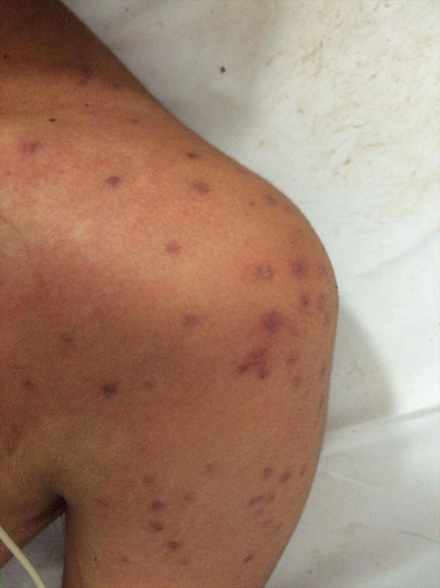 Konya'nın Çumra ilçesinde arılar tarım işçilerine saldırdı: 19 yaralı - Resim: 0