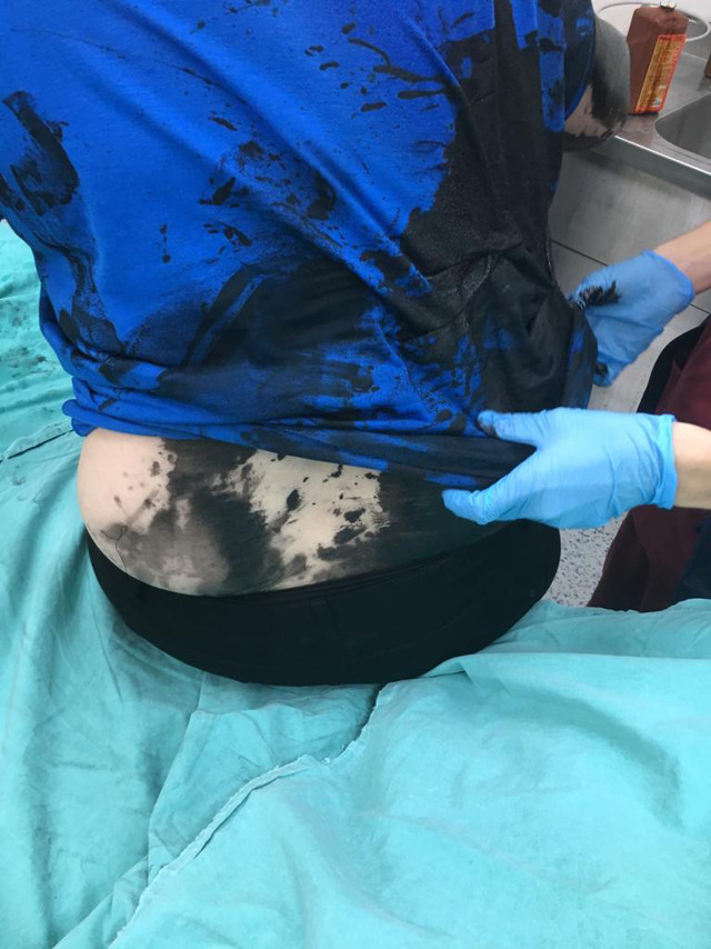 Adana'da bir kadını darbedip üzerine siyah renkli sıvı madde döktüler - Resim: 0