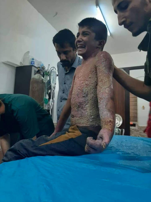 Dünya Sağlık Örgütü'nden fosfor bombası açıklaması - Resim: 0