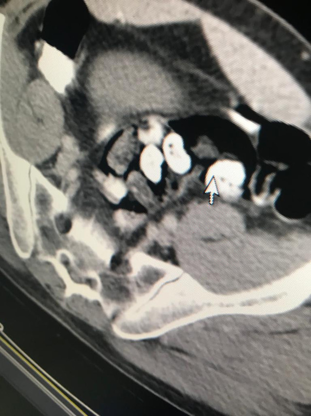 İranlının midesinden çıkan uyuşturucular şaşkınlık yarattı ne ararsan var - Resim: 1